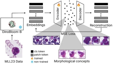 CytoSAE: Interpretable Cell Embeddings for Hematology featured image